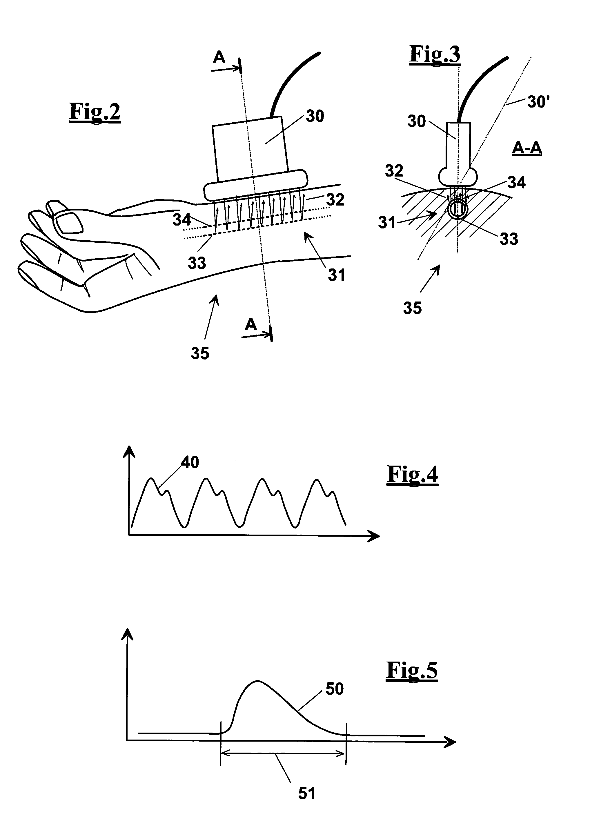 Method and apparatus for automatic examination of cardiovascular functionality indexes by echographic imaging