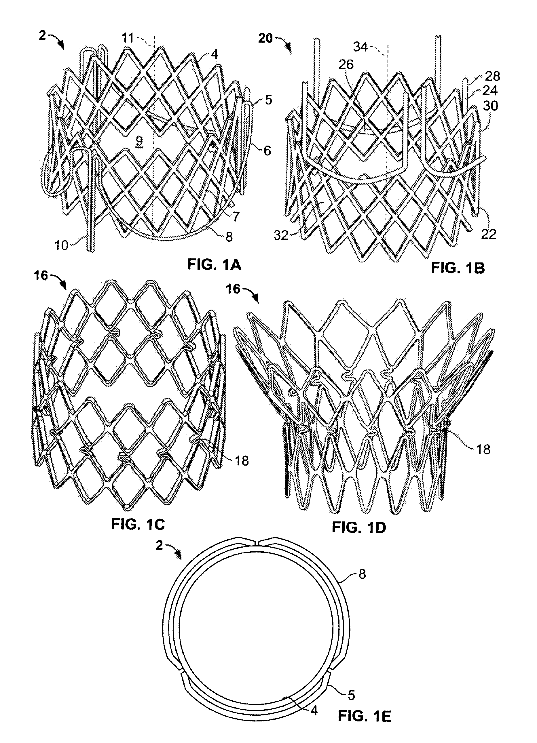 Methods for delivery of a sutureless pulmonary or mitral valve