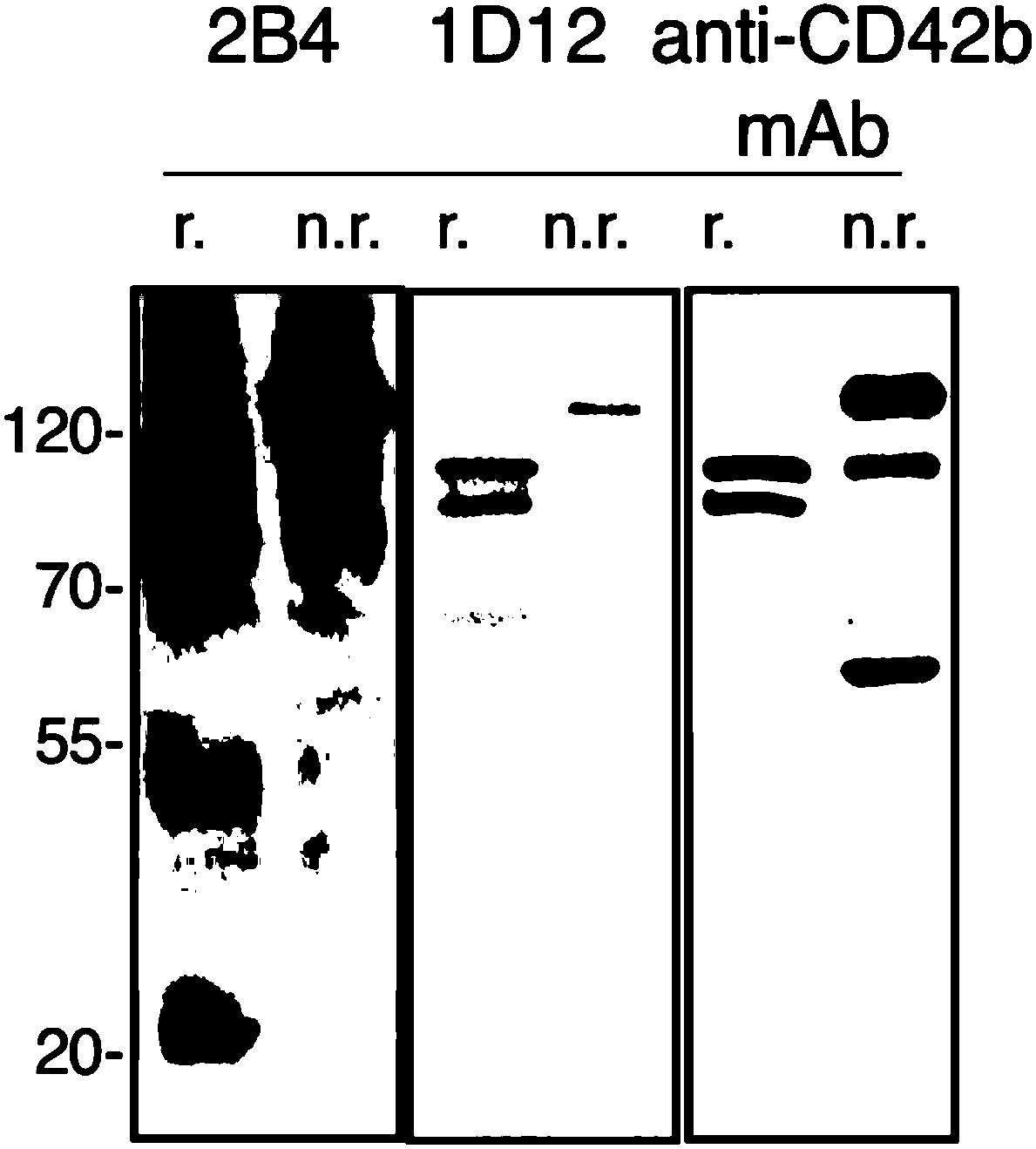 Tumor metastasis inhibitor of targeted mouse platelet membrane glycoprotein GPIb alpha and identification method of inhibitor