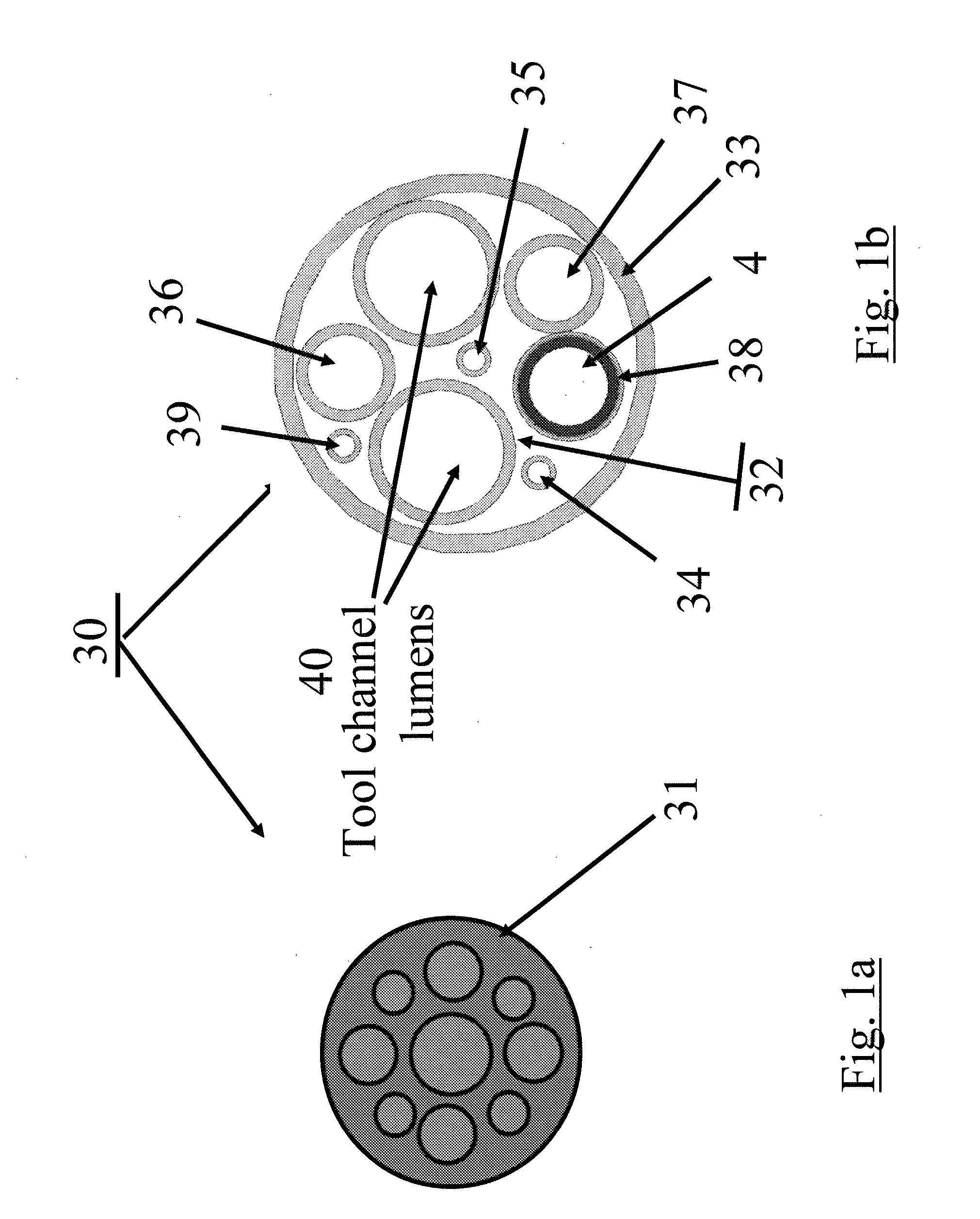 Arrangements and methods for effecting an endoluminal anatomical structure