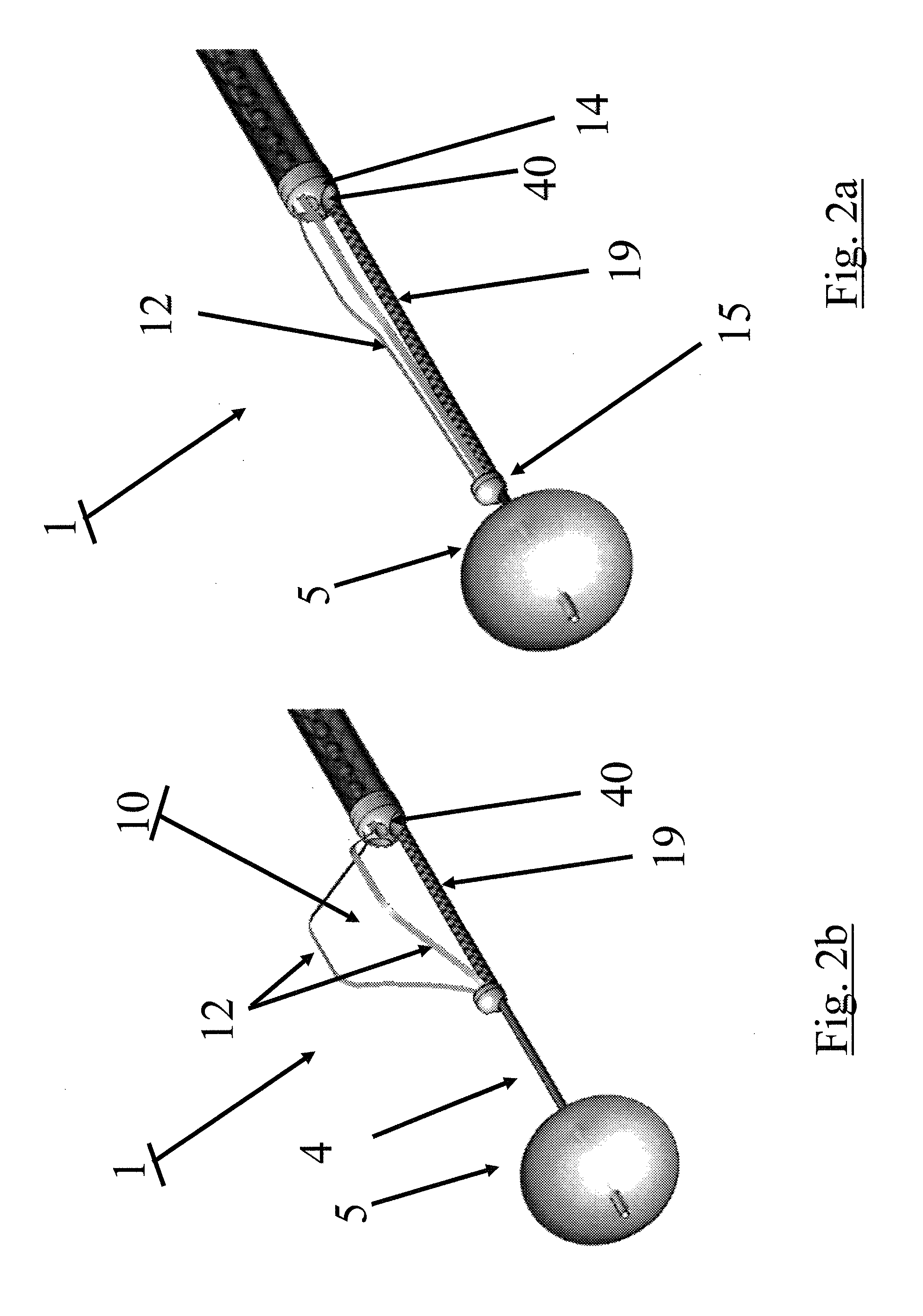 Arrangements and methods for effecting an endoluminal anatomical structure