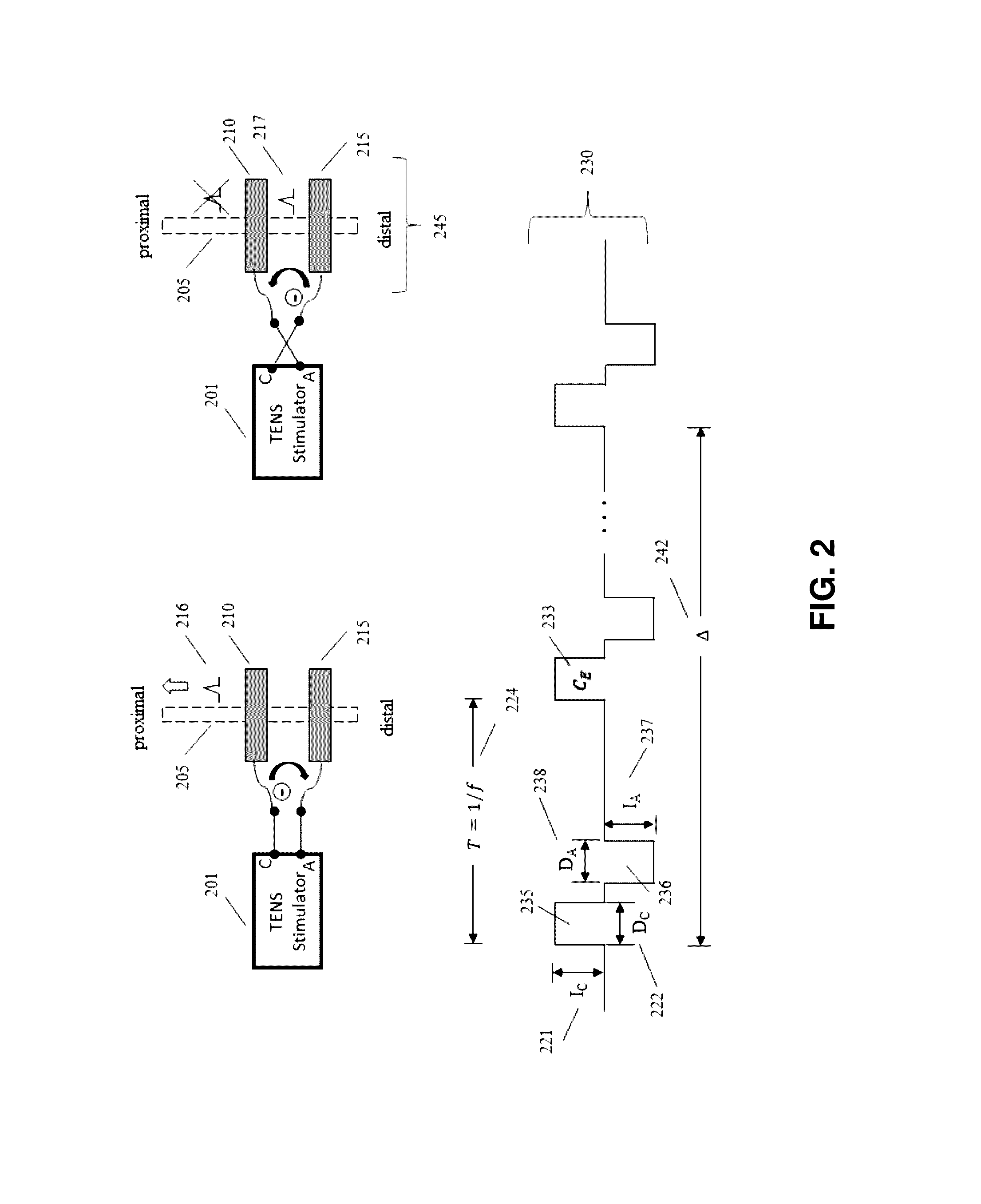 Transcutaneous electrical nerve stimulation using novel unbalanced biphasic waveform and novel electrode arrangement