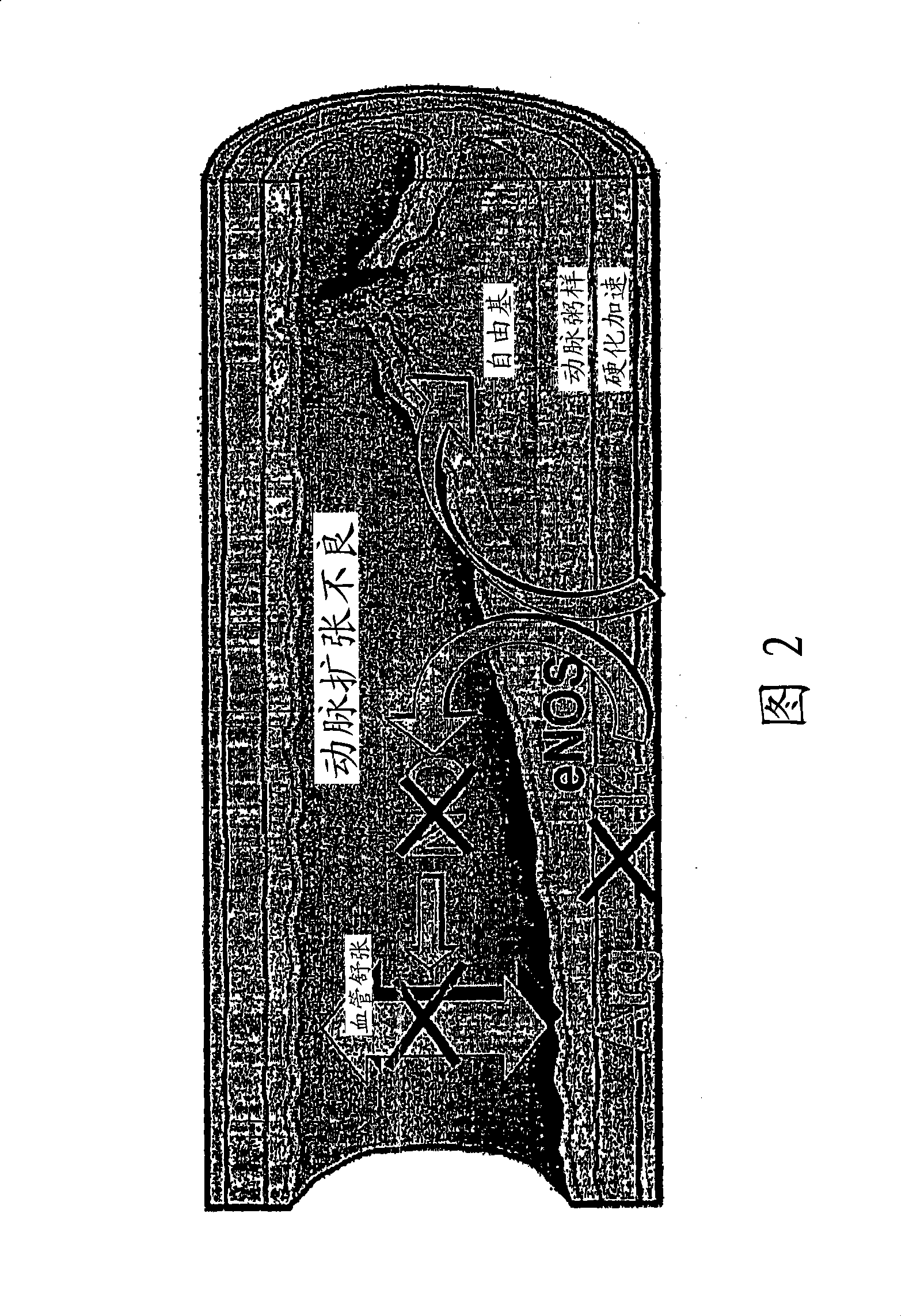 Methods and compositions for the treatment of vascular disease