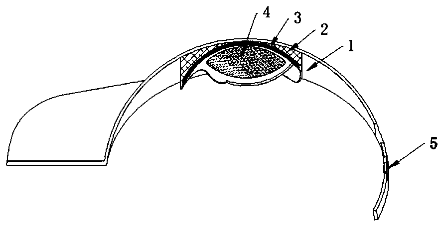 Personalized skull defect protection device and preparation method
