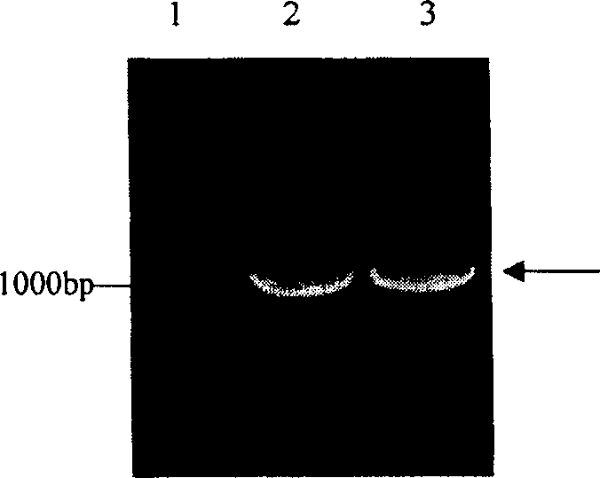 Recombined diphtheria toxin, preparation method, and application