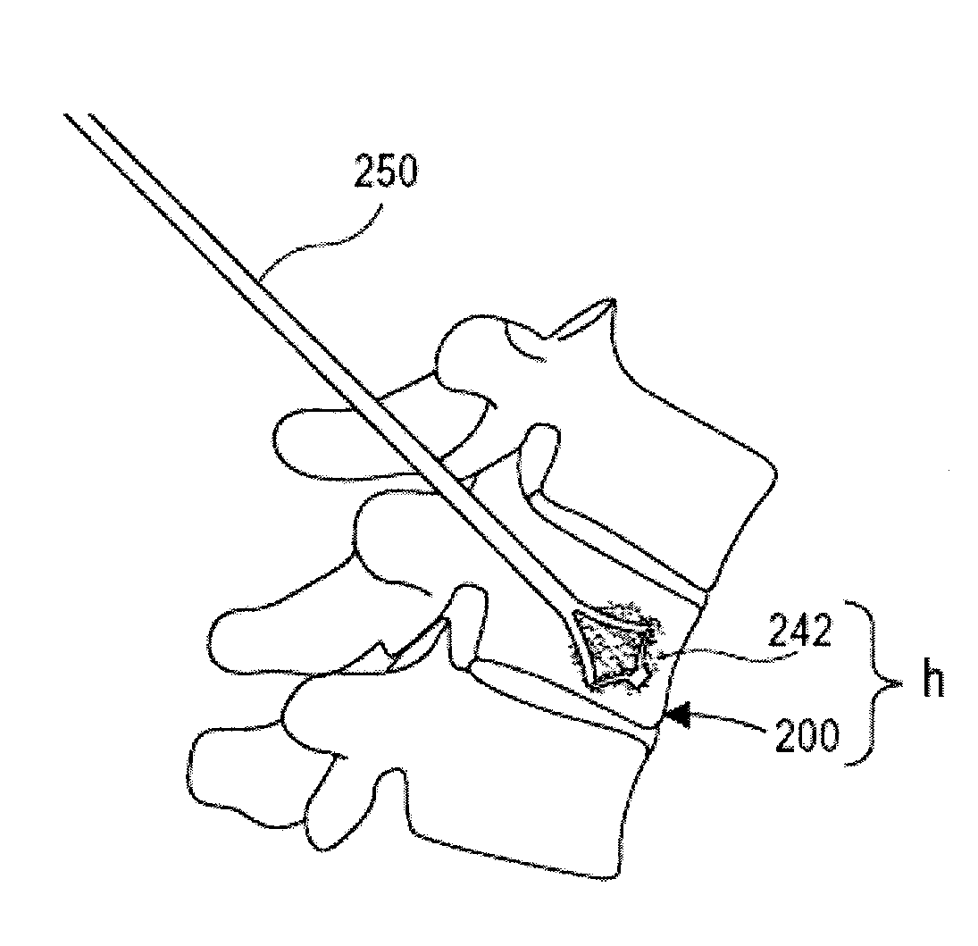 Implantable devices and methods for treating micro-architecture deterioration of bone tissue