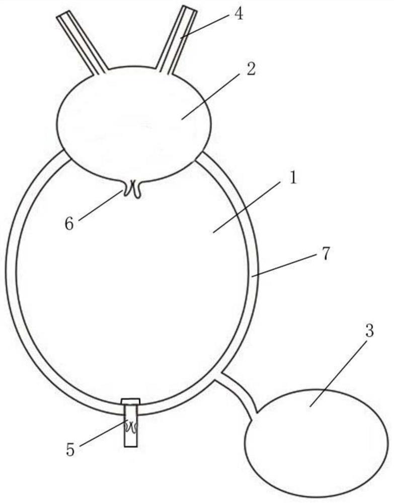 Artificial bladder capable of preventing regurgitation