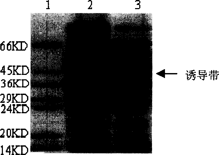 Interleukin-2 and enterotoxin B fusion gene and its preparation