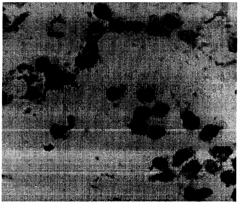 Kit for LAMIN A gene hybridization in situ, detection method and use thereof