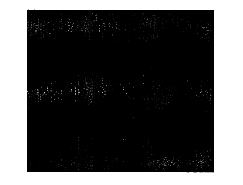 Kit for LAMIN A gene hybridization in situ, detection method and use thereof