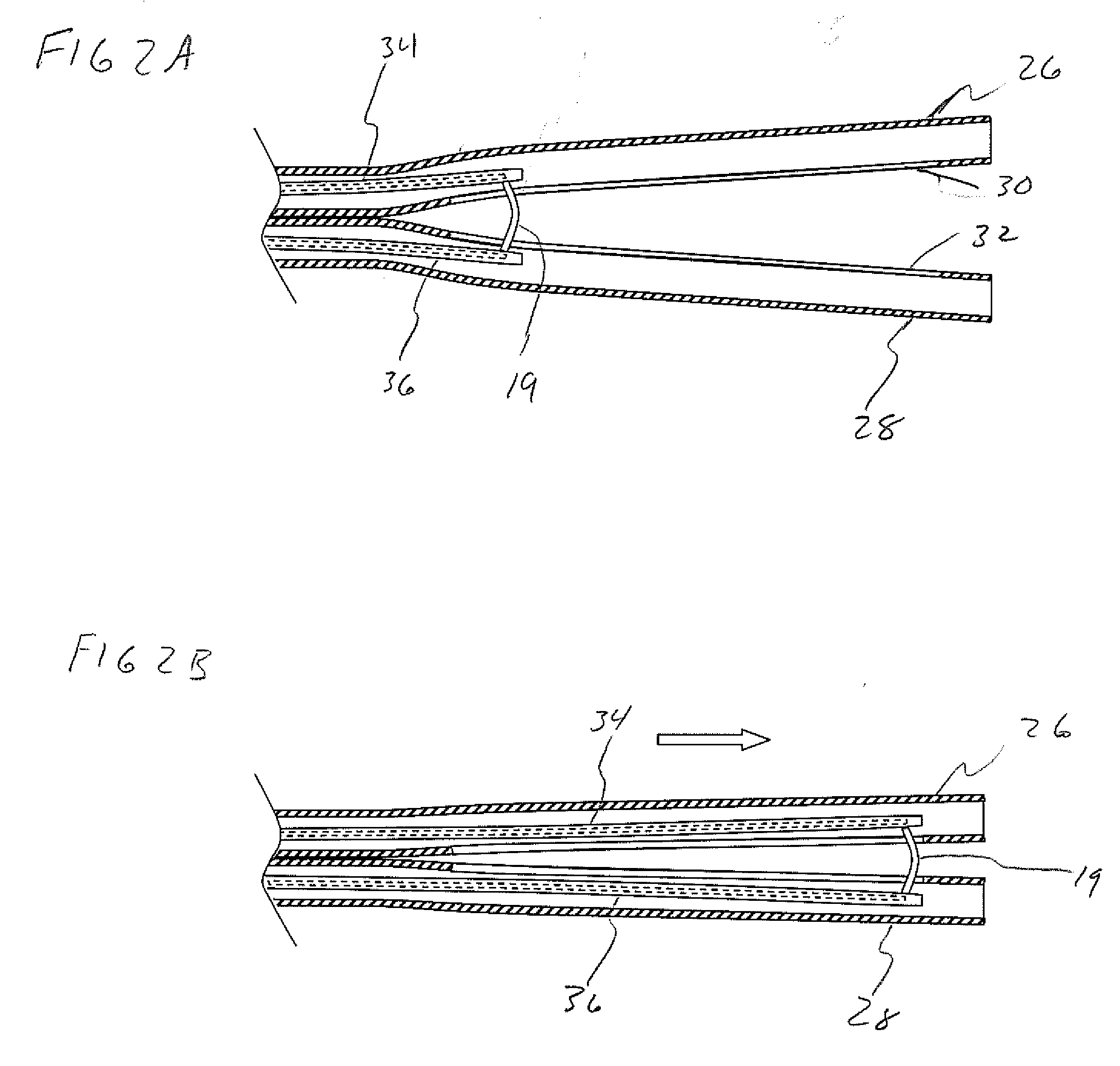 Tissue Resection Device