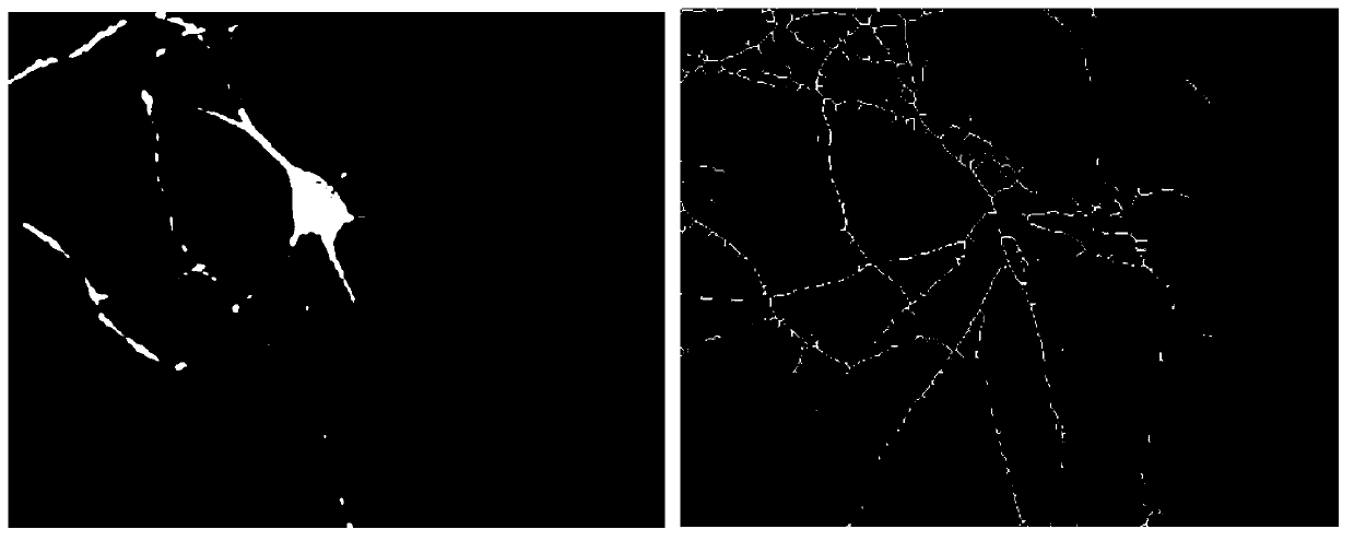 Nerve dendritic spine image classification method based on multiresolution fractal features