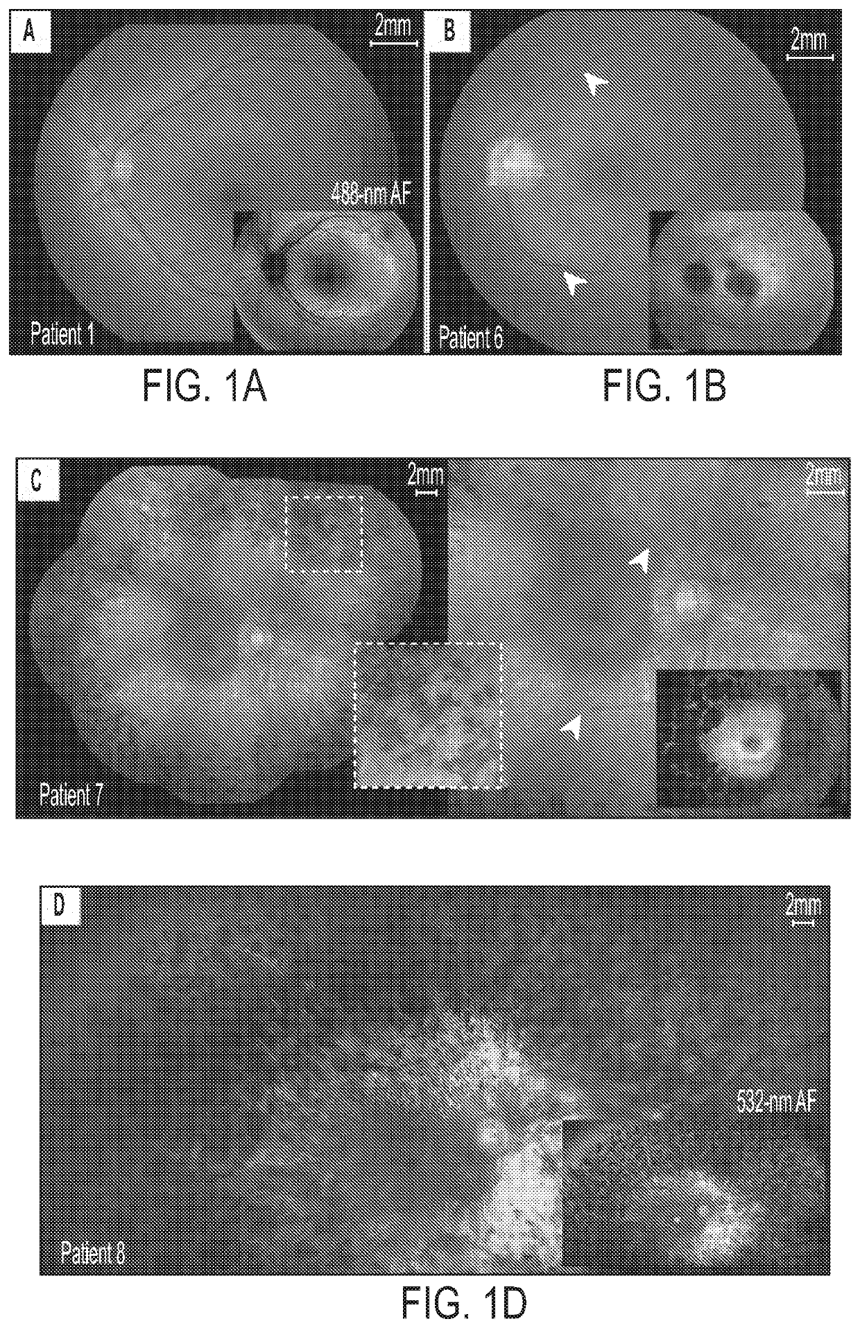 Enhanced human opsin promoter for rod specific expression