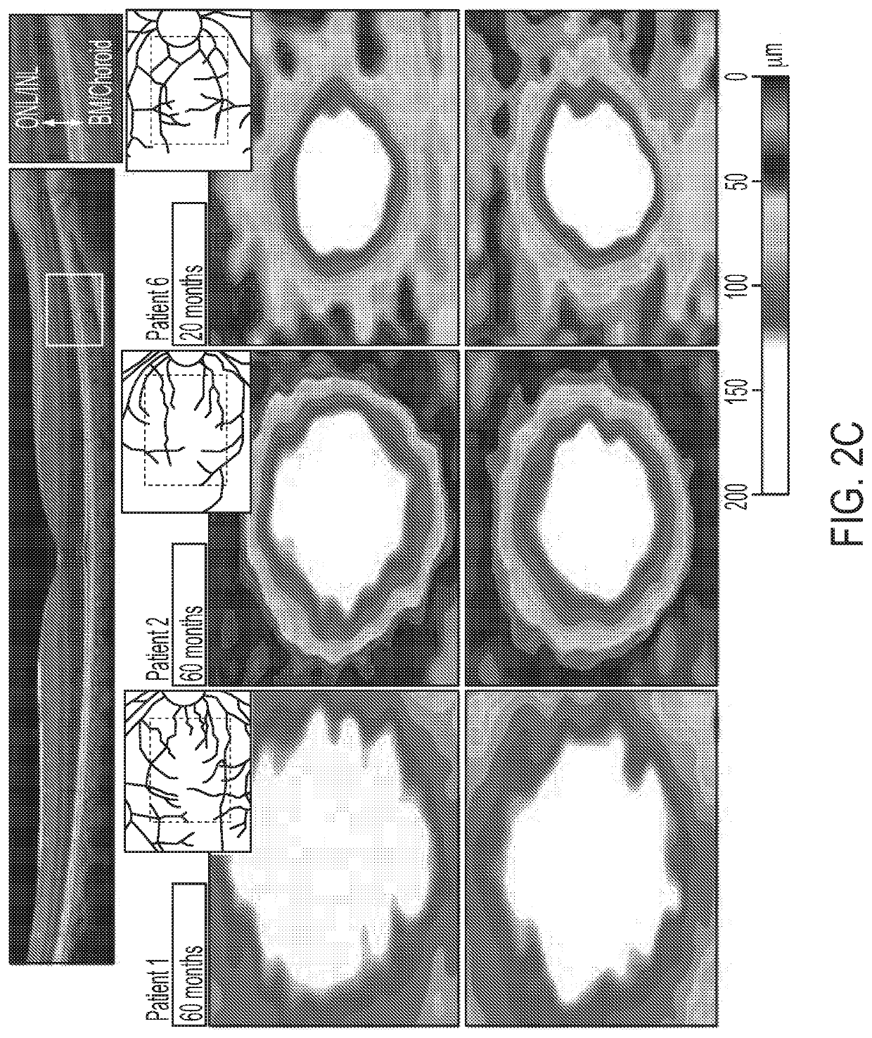 Enhanced human opsin promoter for rod specific expression