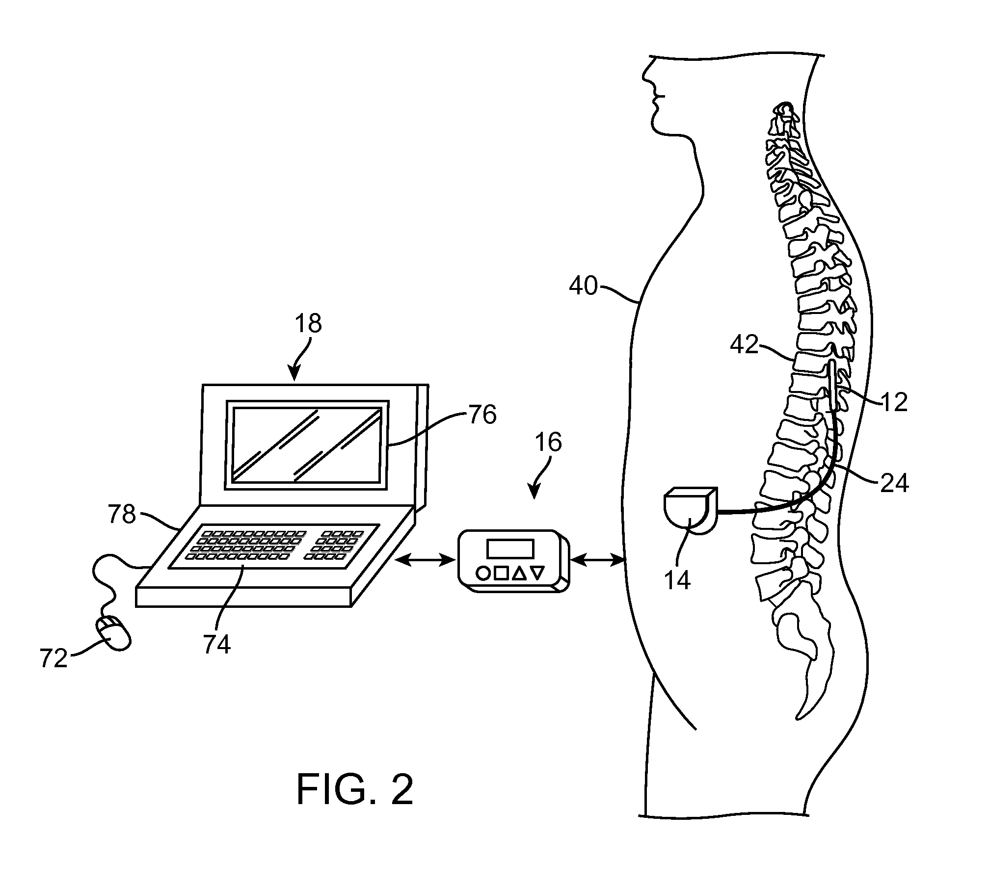 Technique for linking electrodes together during programming of neurostimulation system