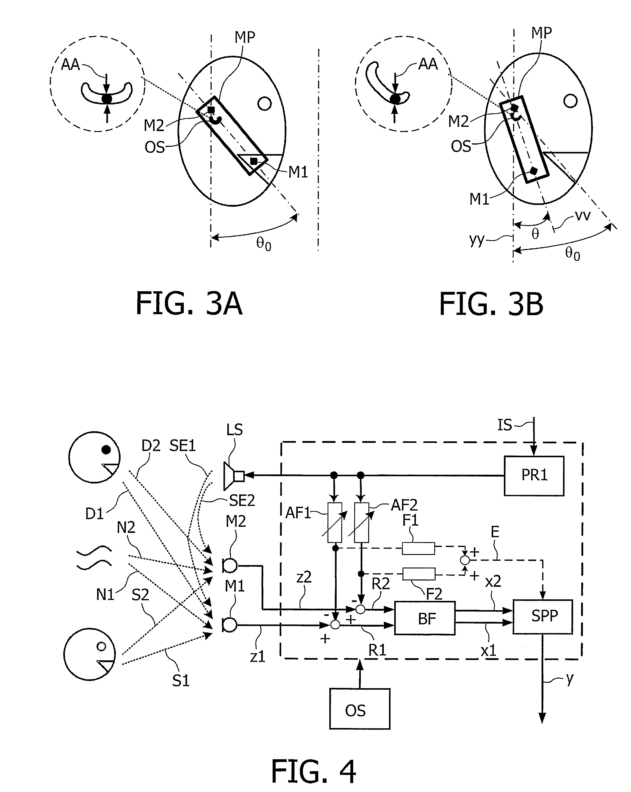 Telephony Device with Improved Noise Suppression