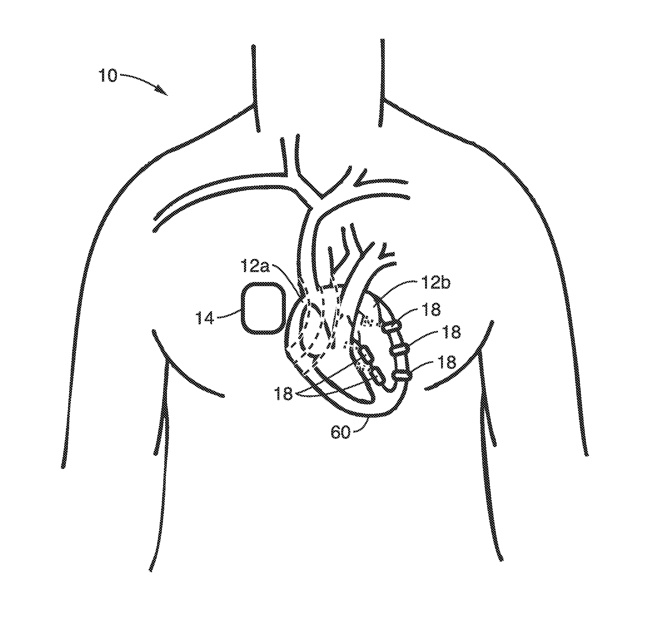 Intelligent self-organizing electrode stimulation delivery system