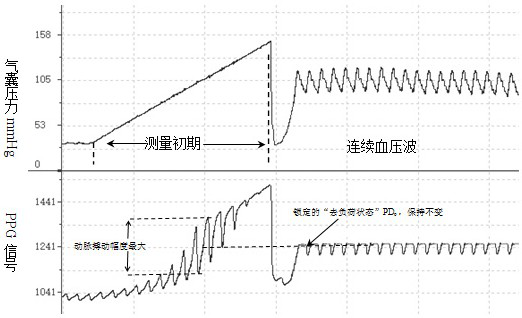 Automatic real-time calibration method for continuous blood pressure measurement