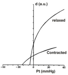 Automatic real-time calibration method for continuous blood pressure measurement