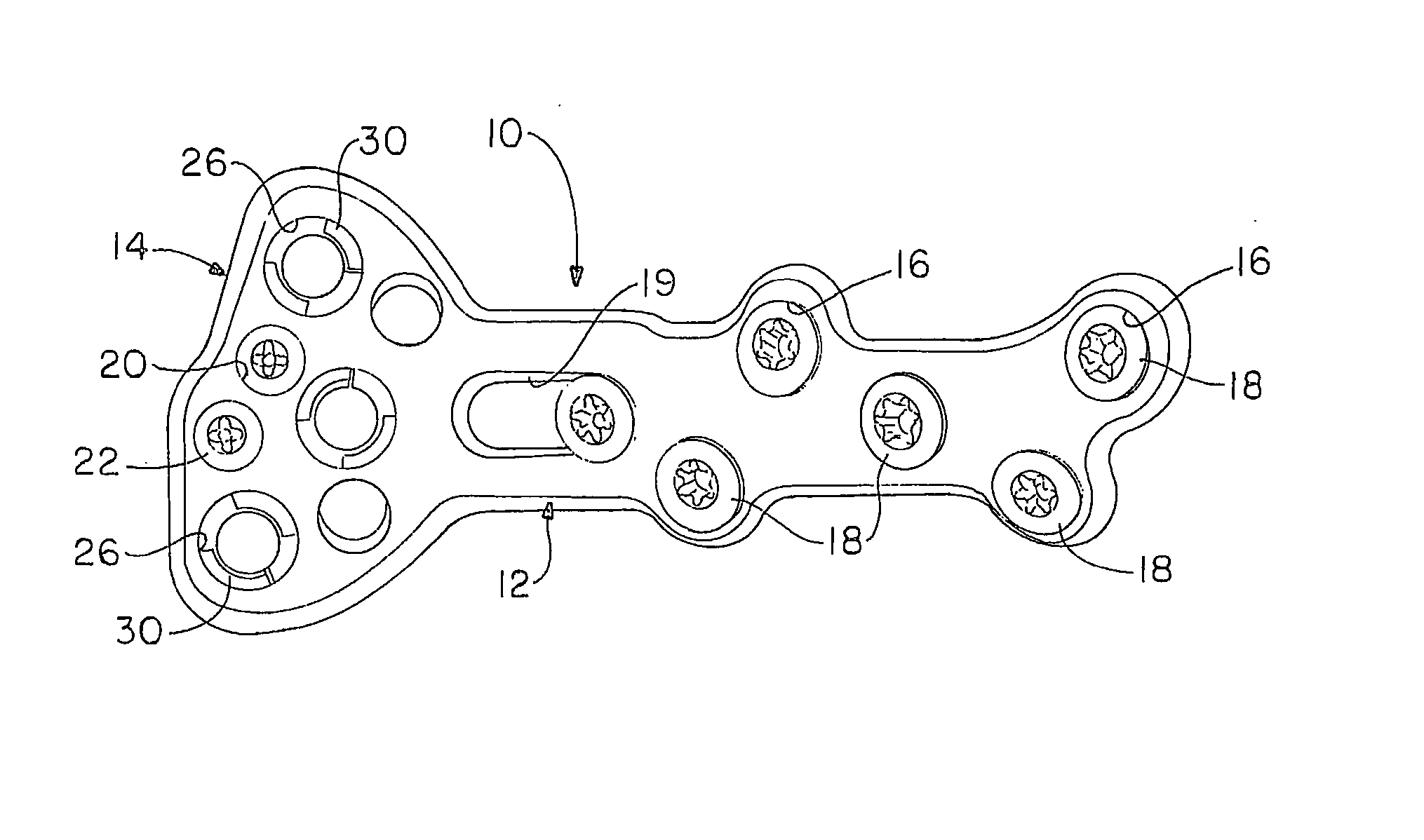 Orthopedic plate having threaded holes for locking screws or pegs and non-threaded holes for a variable axis locking mechanism