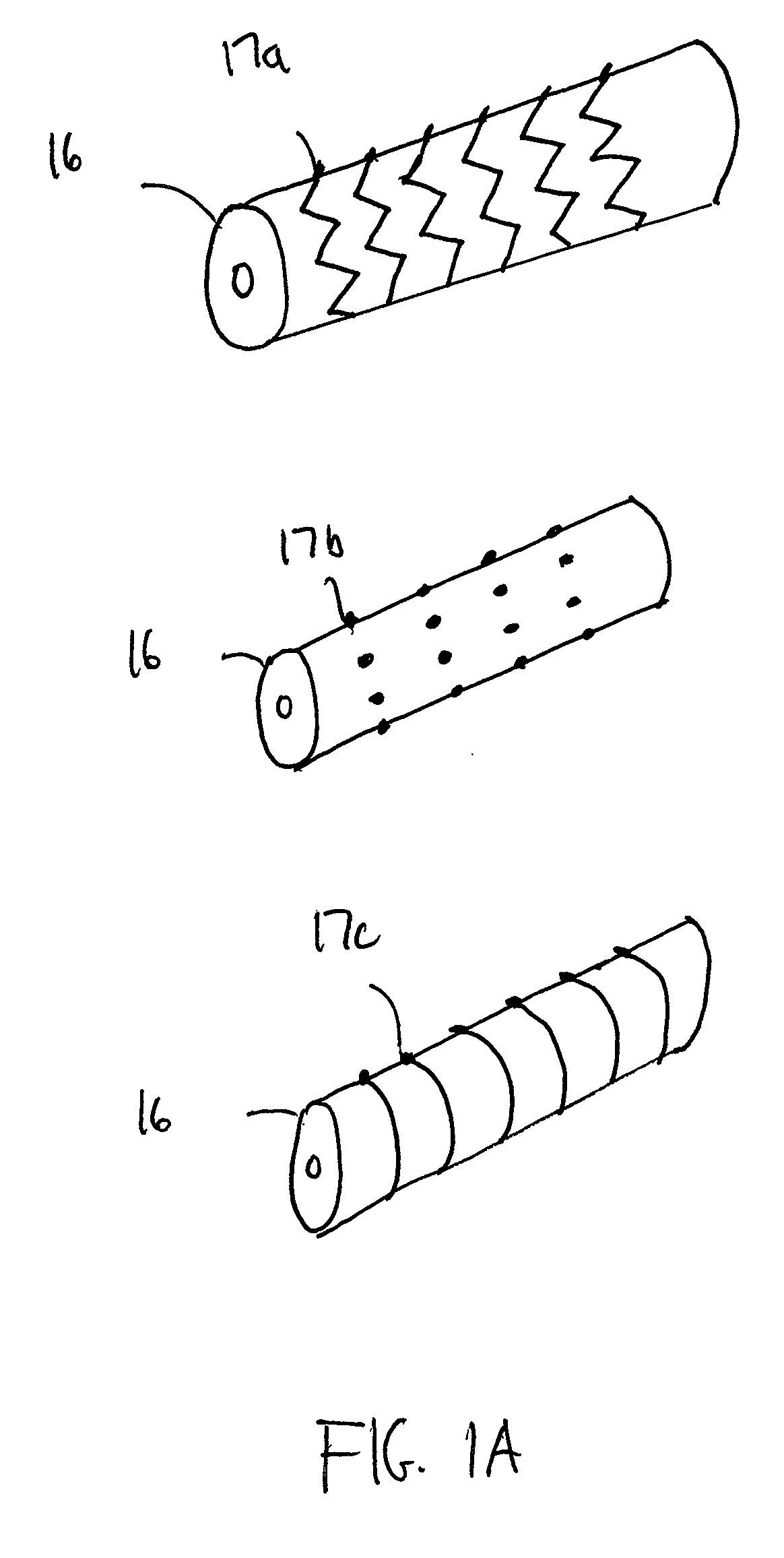 Apparatus and method for treating tissue