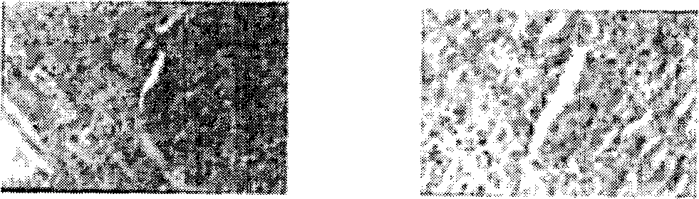 Method and equipment for setting medical care device of ultrasound microbubble contrast media to form embolism in capillary vessel