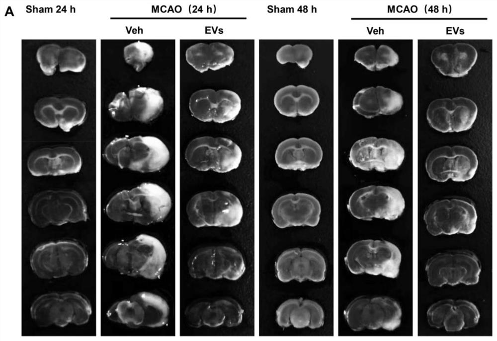 Application of extracellular vesicles derived from mesenchymal stem cells in cerebral ischemia-reperfusion injury