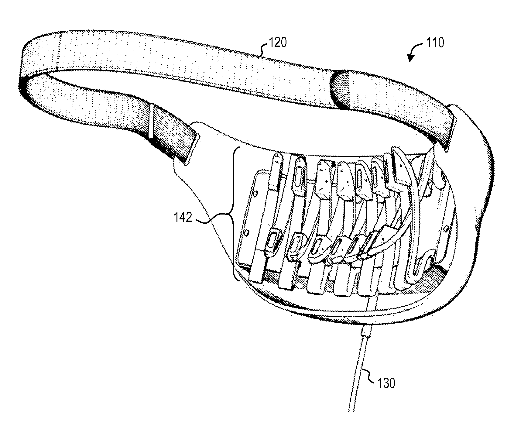 Headache-treatment device with gel dispensing kit and method