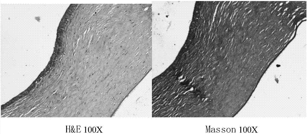 Adipose-derived stem cell preparation eye drops for treating corneal injury and preparation method thereof