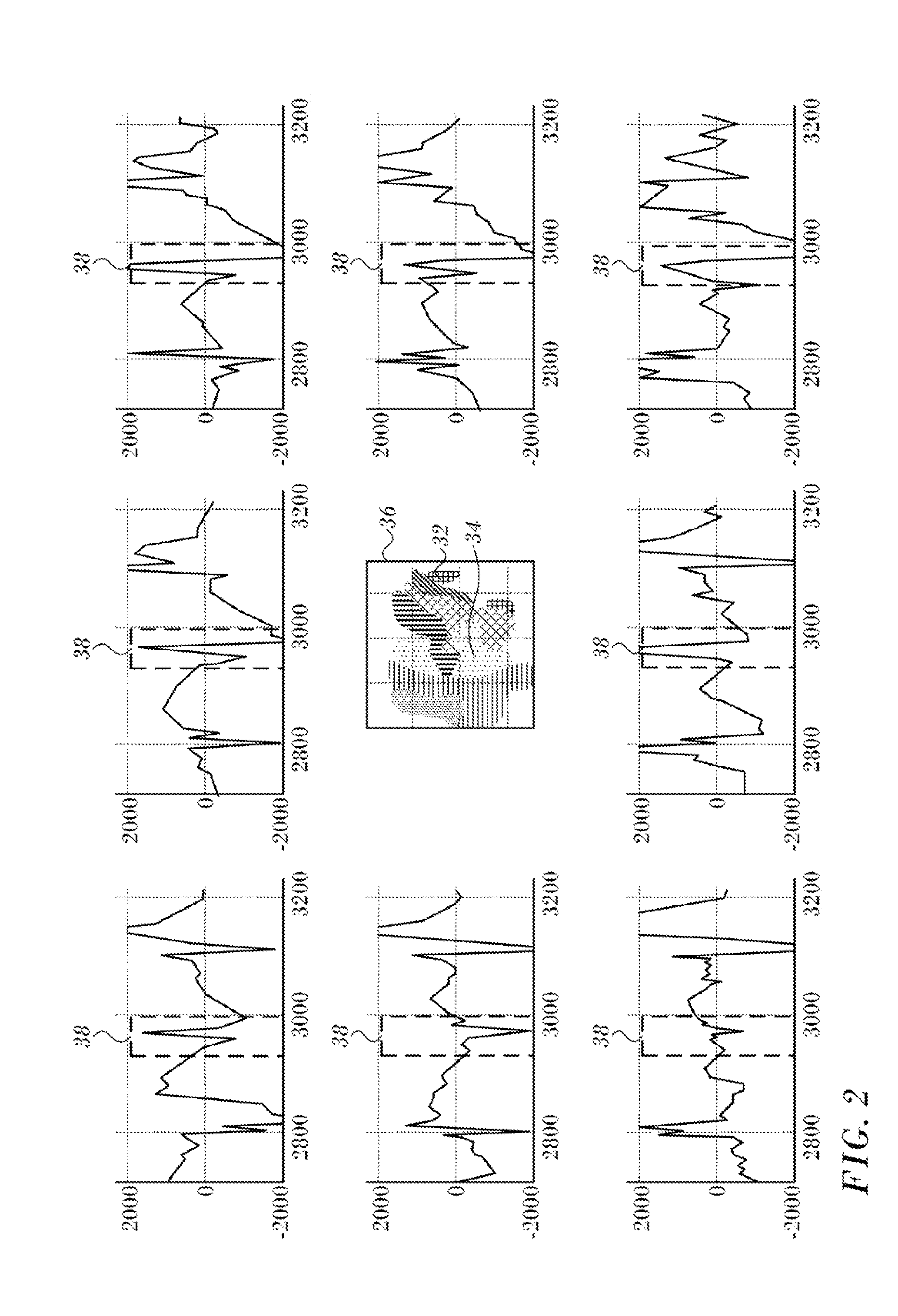 Double bipolar configuration for atrial fibrillation annotation