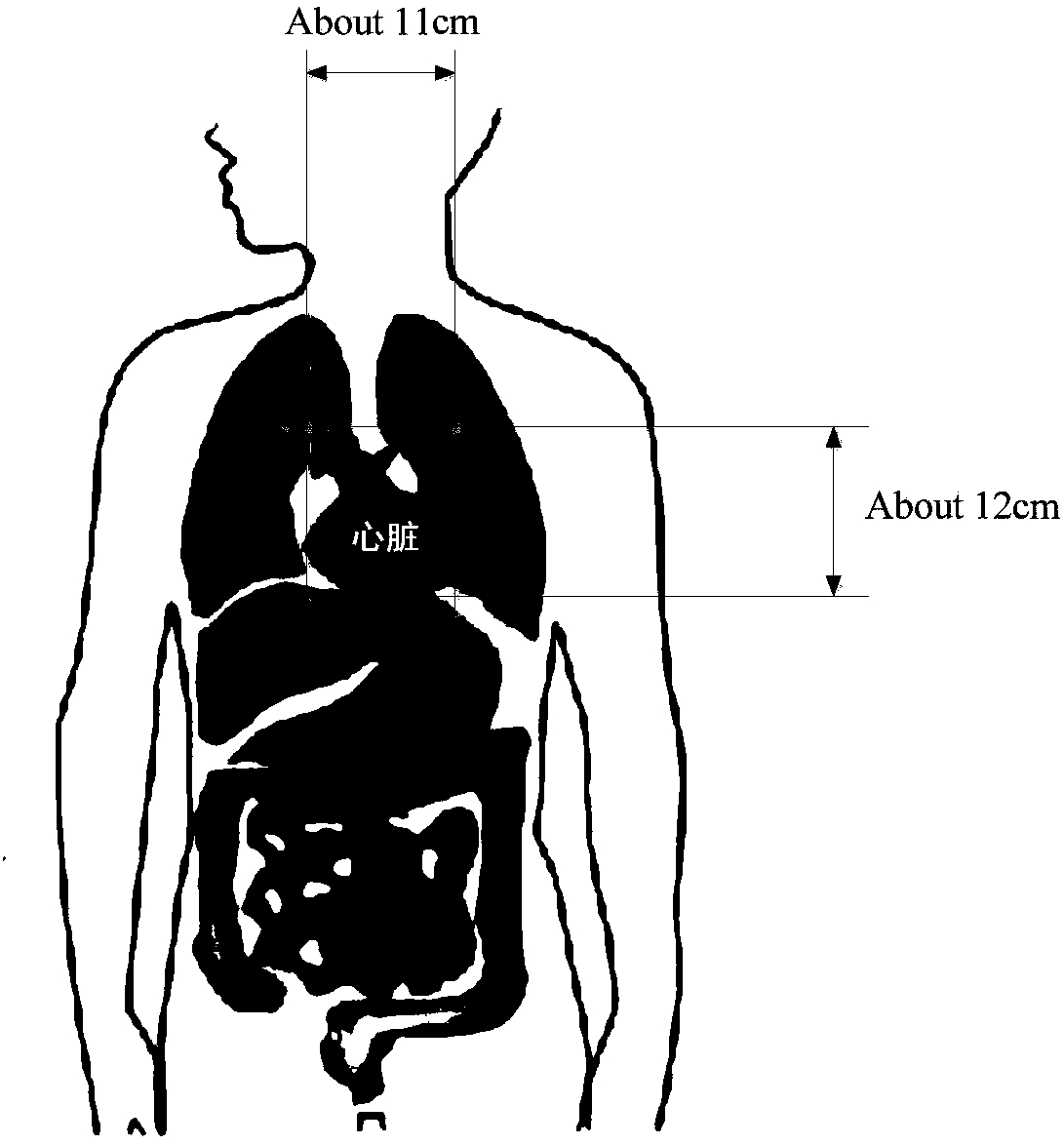 One-dimensional radar array optimization method based on non-contact vital signs monitoring system