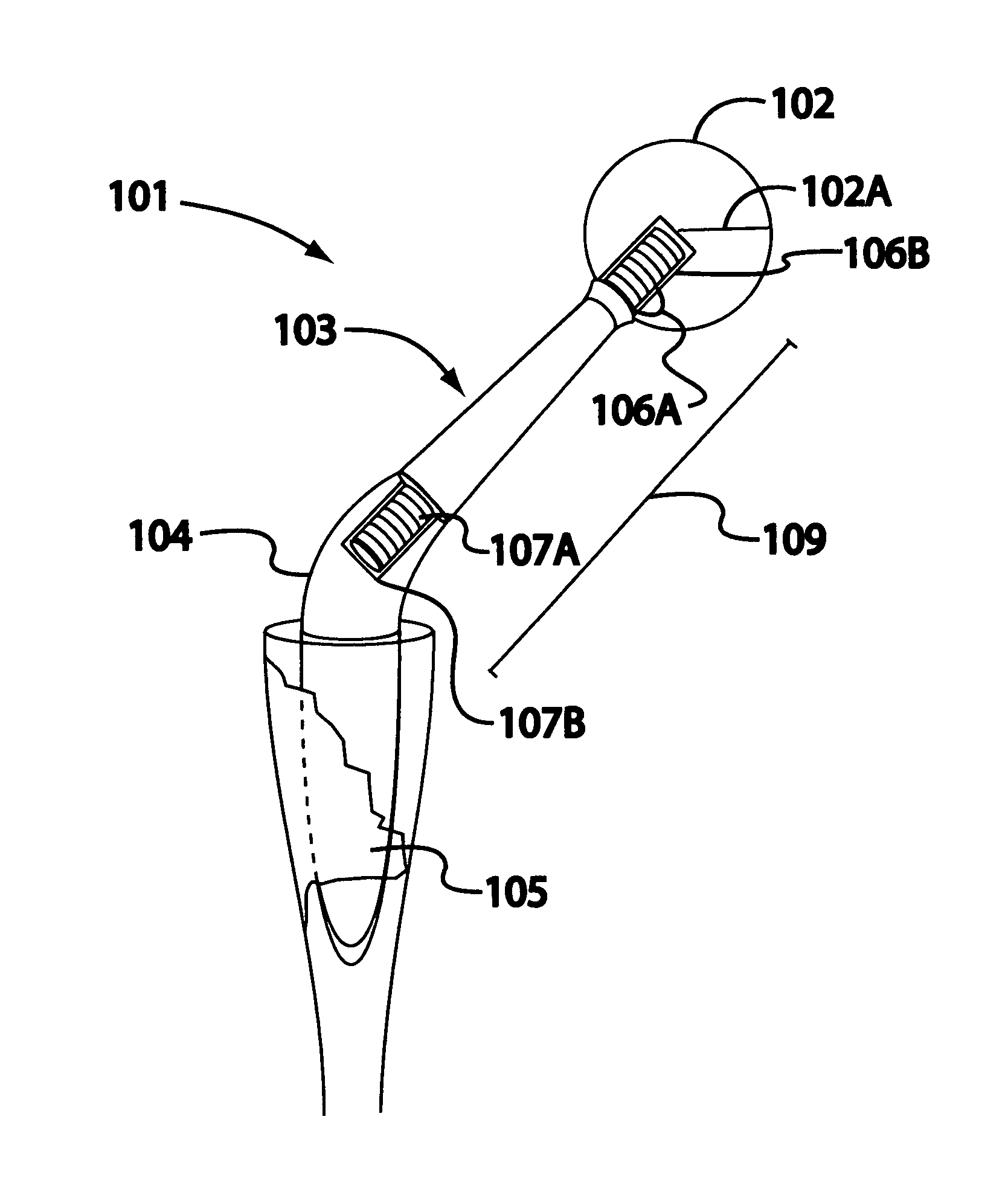 Temporary, modular, hip joint with neck-length modification mechanism