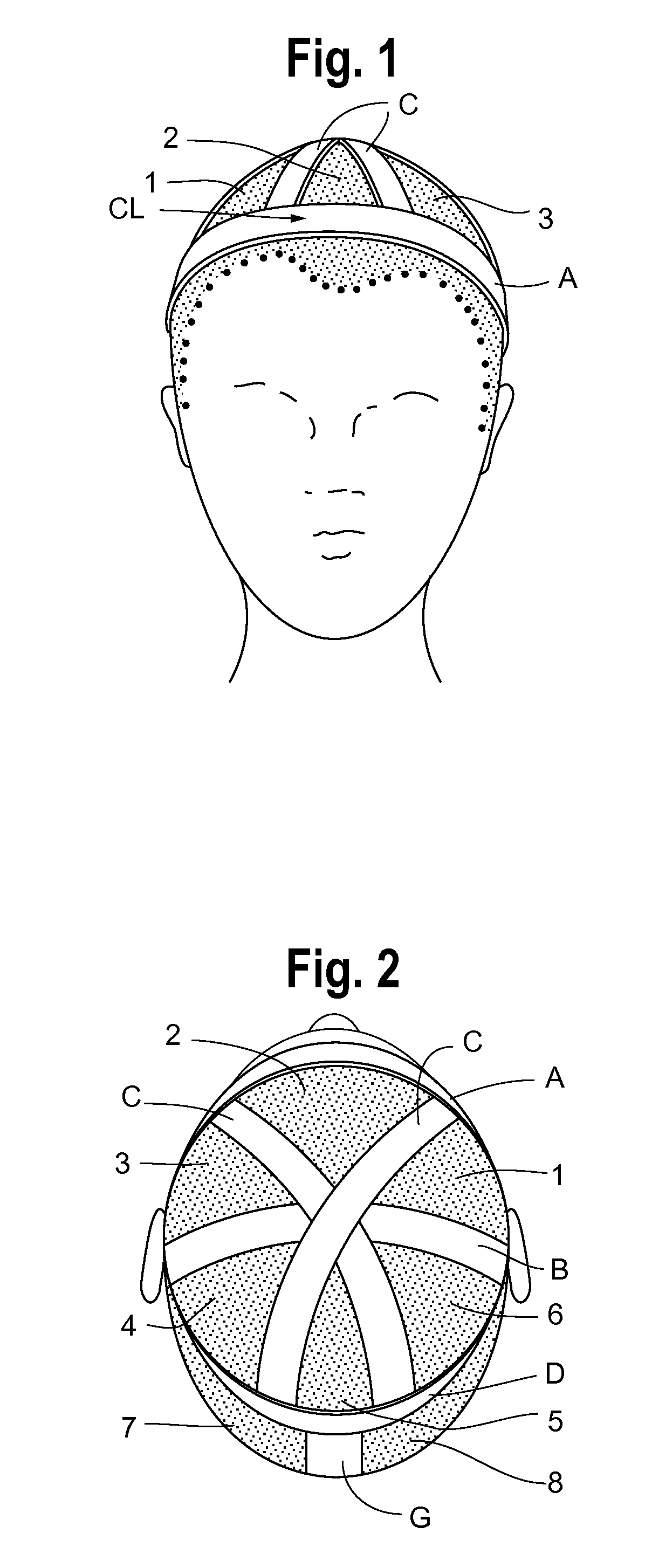 Hair Integration Assembly