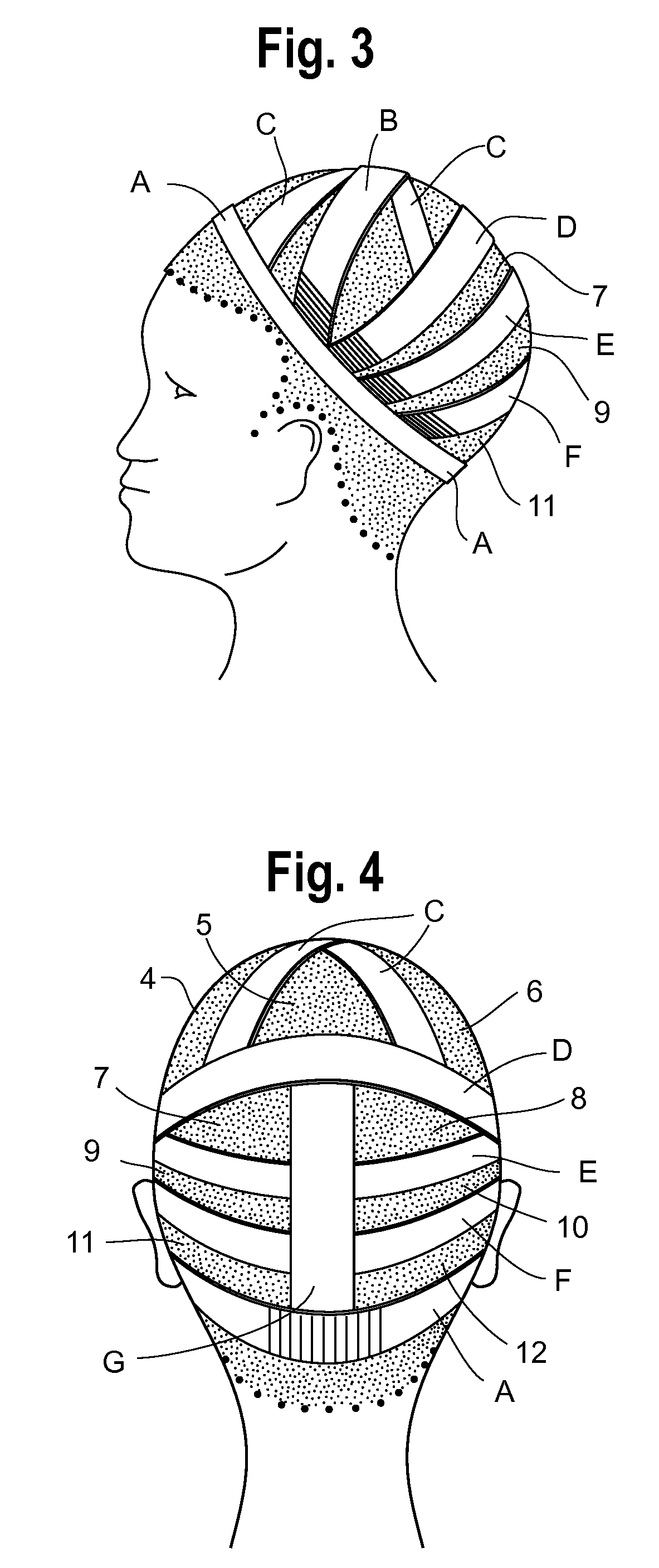 Hair Integration Assembly