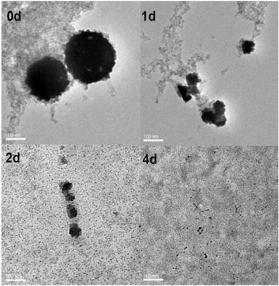 Degradable organic and inorganic composite nano-particle capable of realizing anti-tumor treatment, and preparation method thereof