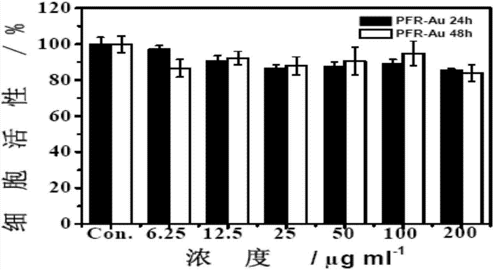 Degradable organic and inorganic composite nano-particle capable of realizing anti-tumor treatment, and preparation method thereof