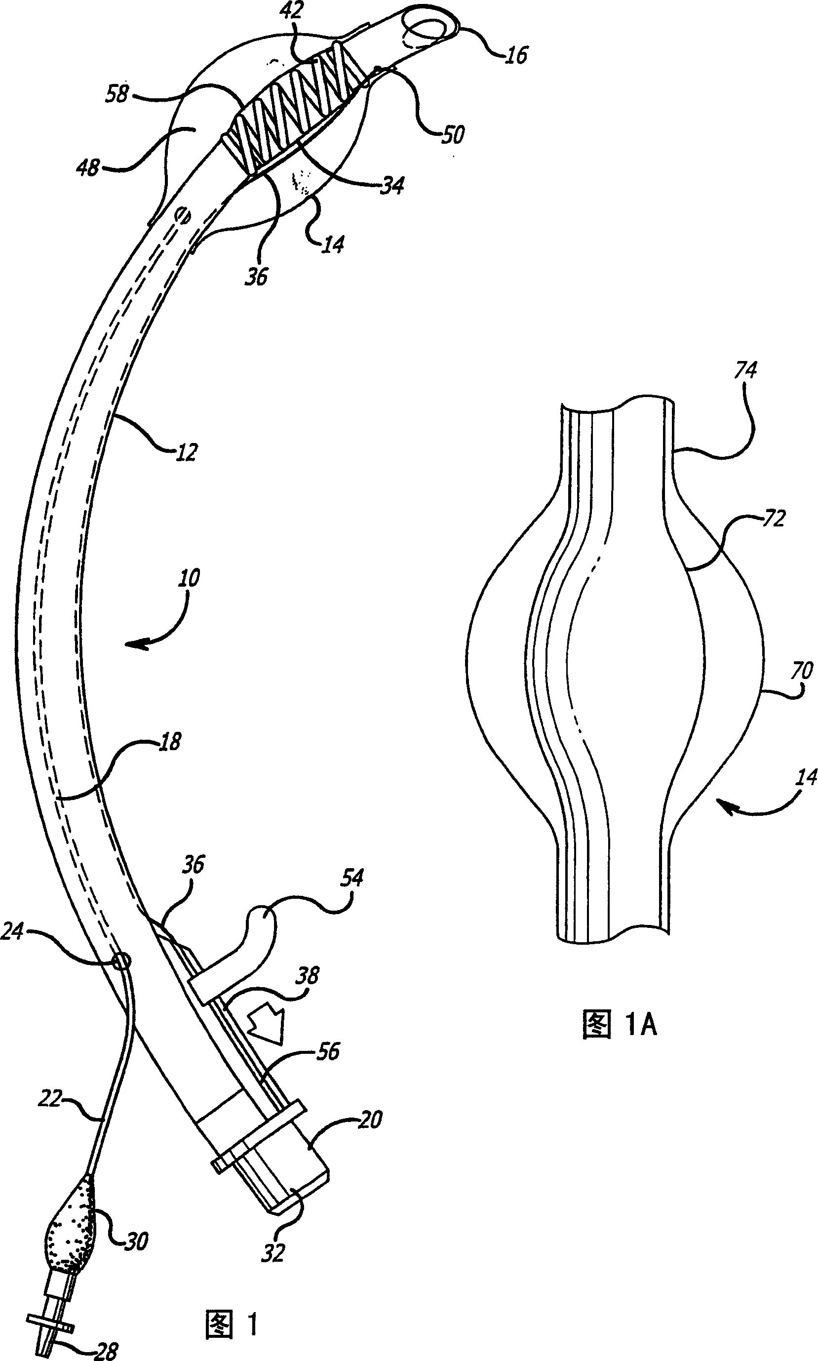 Endotracheal tube with tip directional control and position preserving mechanism