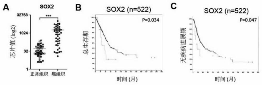 Application of SOX2 targeted drug to inhibiting proliferation of lung cancer stem cells