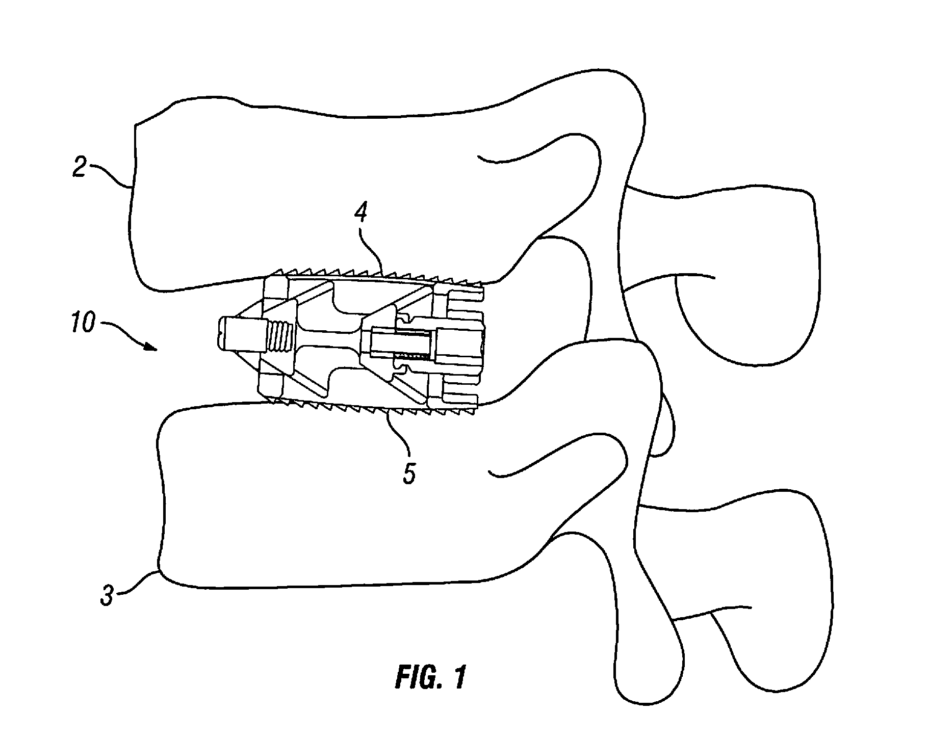 Expandable fusion device and method of installation thereof