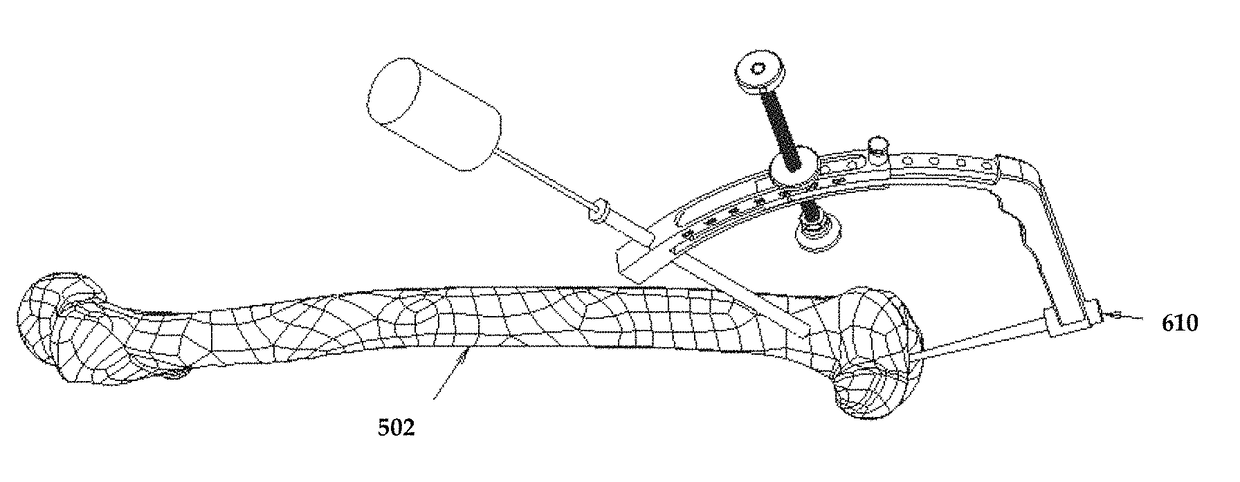 3-D femur orthopedic drill guide