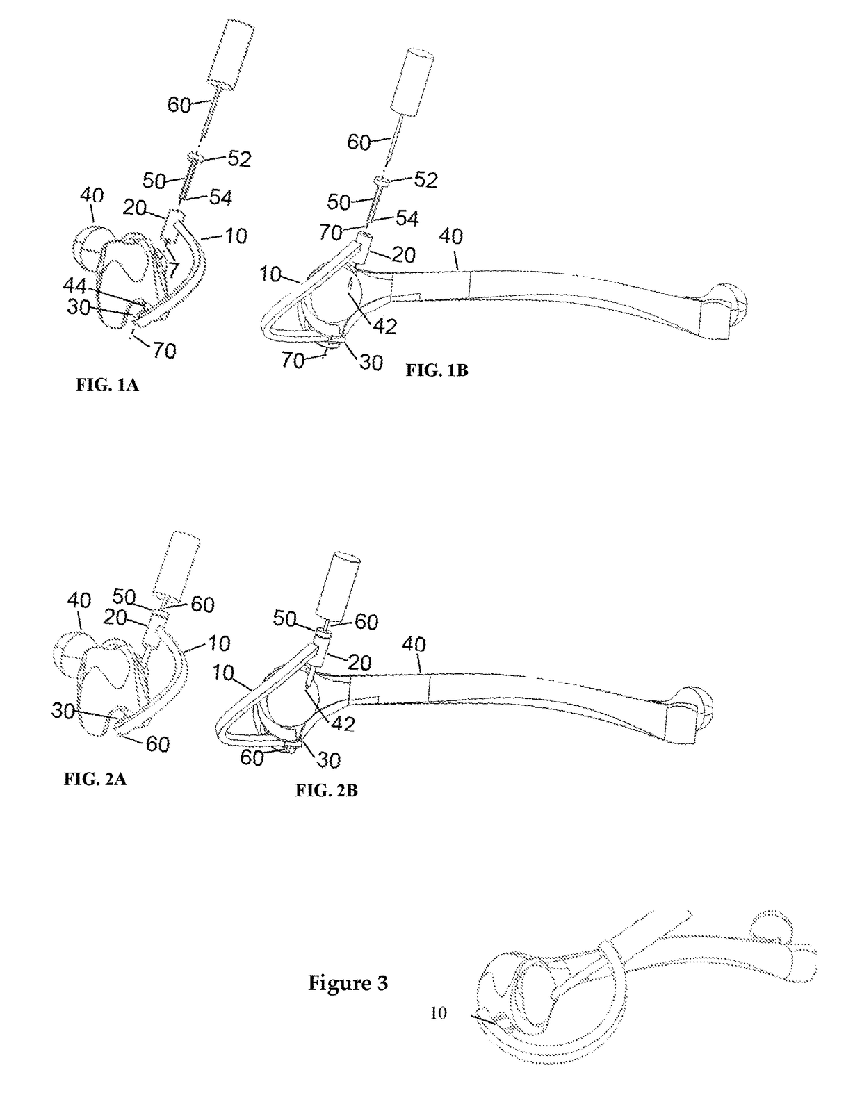 3-D femur orthopedic drill guide