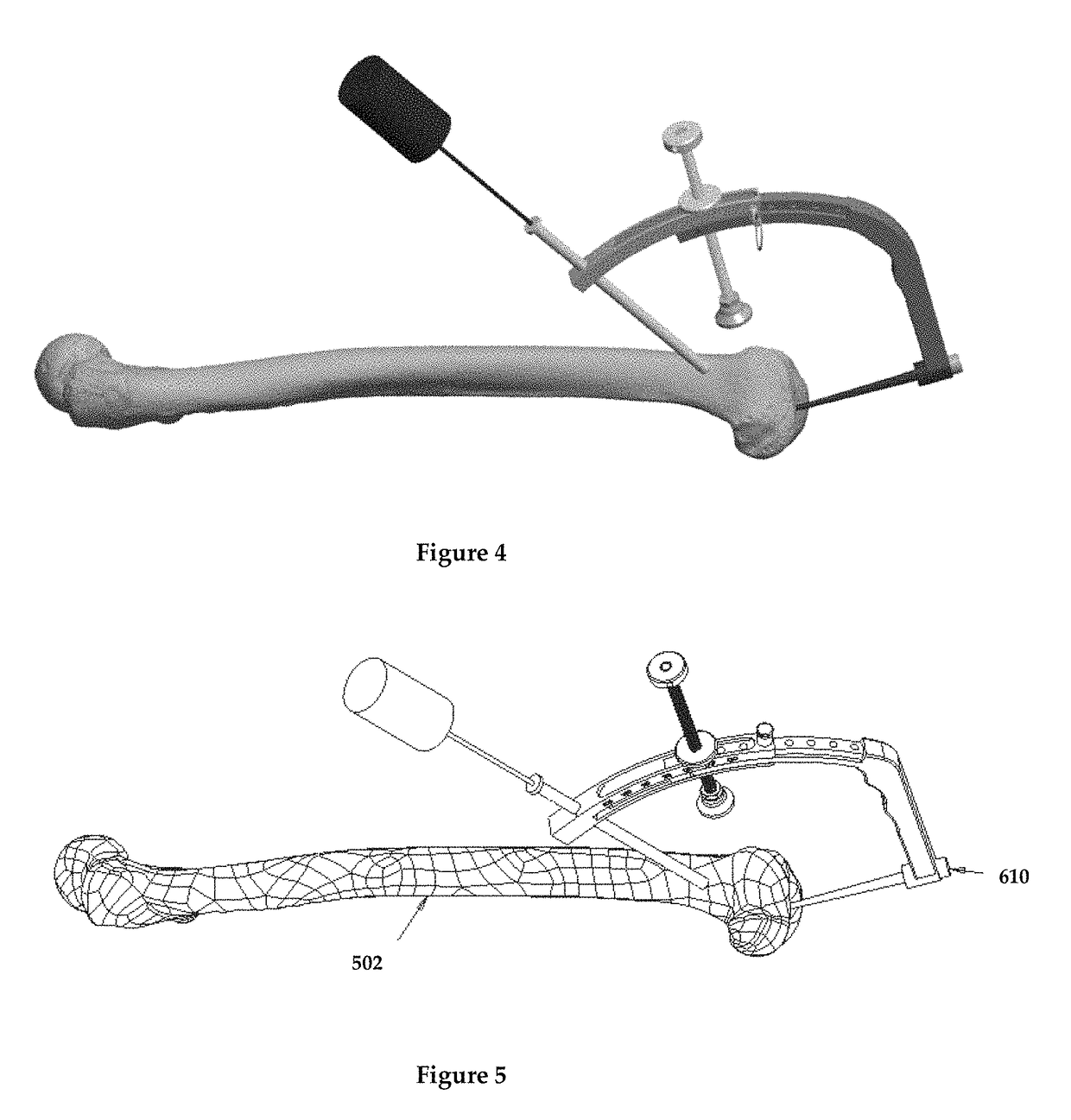 3-D femur orthopedic drill guide