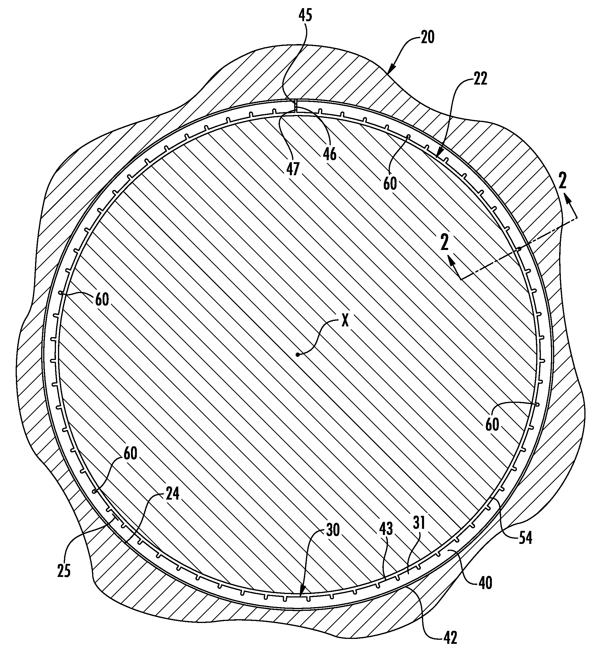 Radially notched piston rings