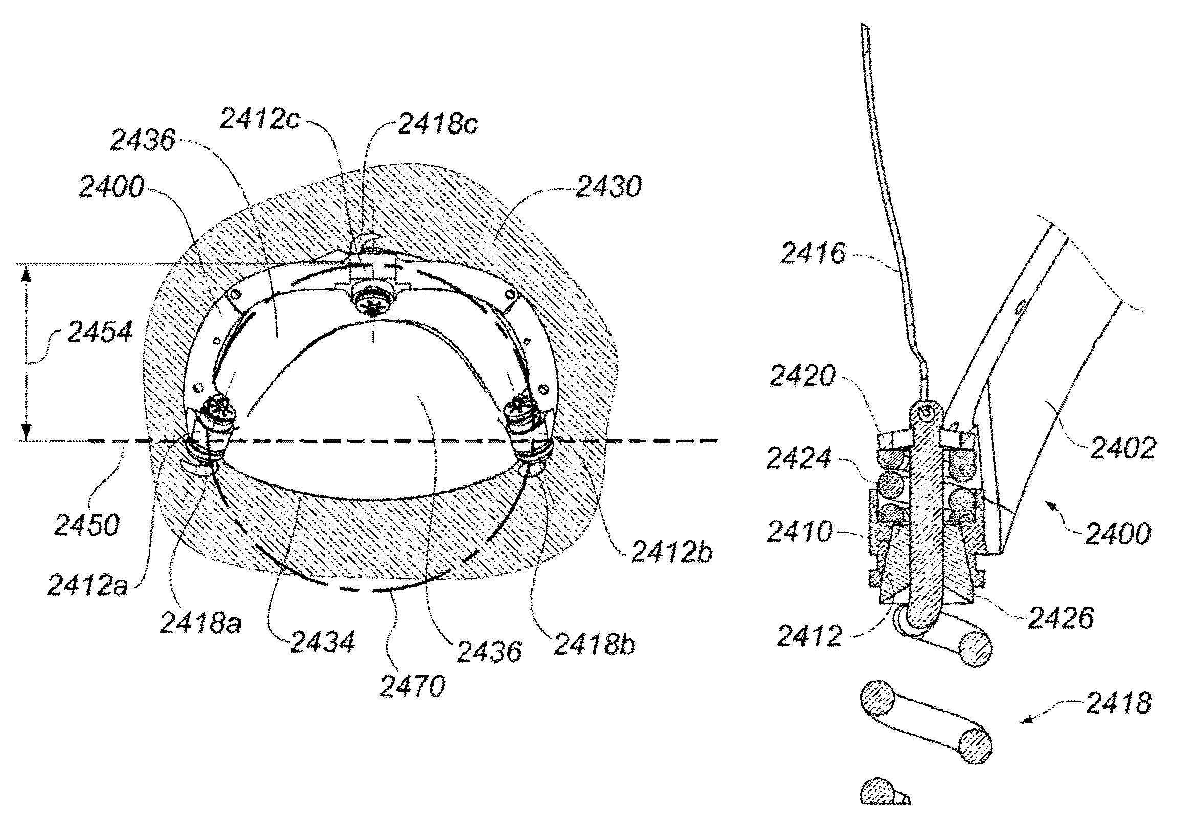 Medical device, kit and method for constricting tissue or a bodily orifice, for example, a mitral valve