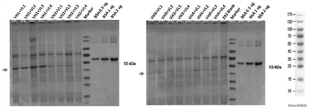 Anti-platelet membrane glycoprotein IB ALPHA humanized antibody and application thereof