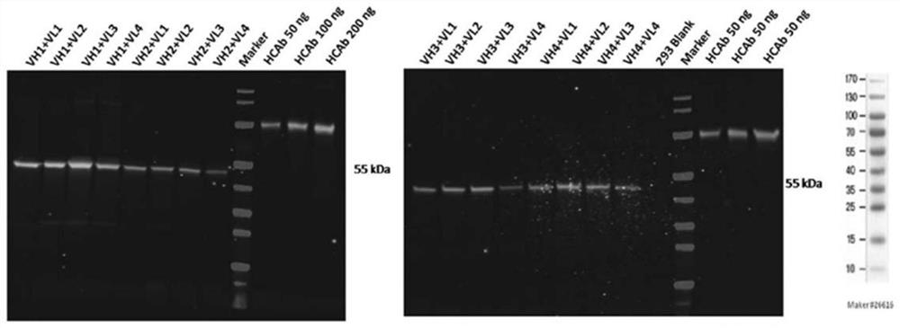 Anti-platelet membrane glycoprotein IB ALPHA humanized antibody and application thereof
