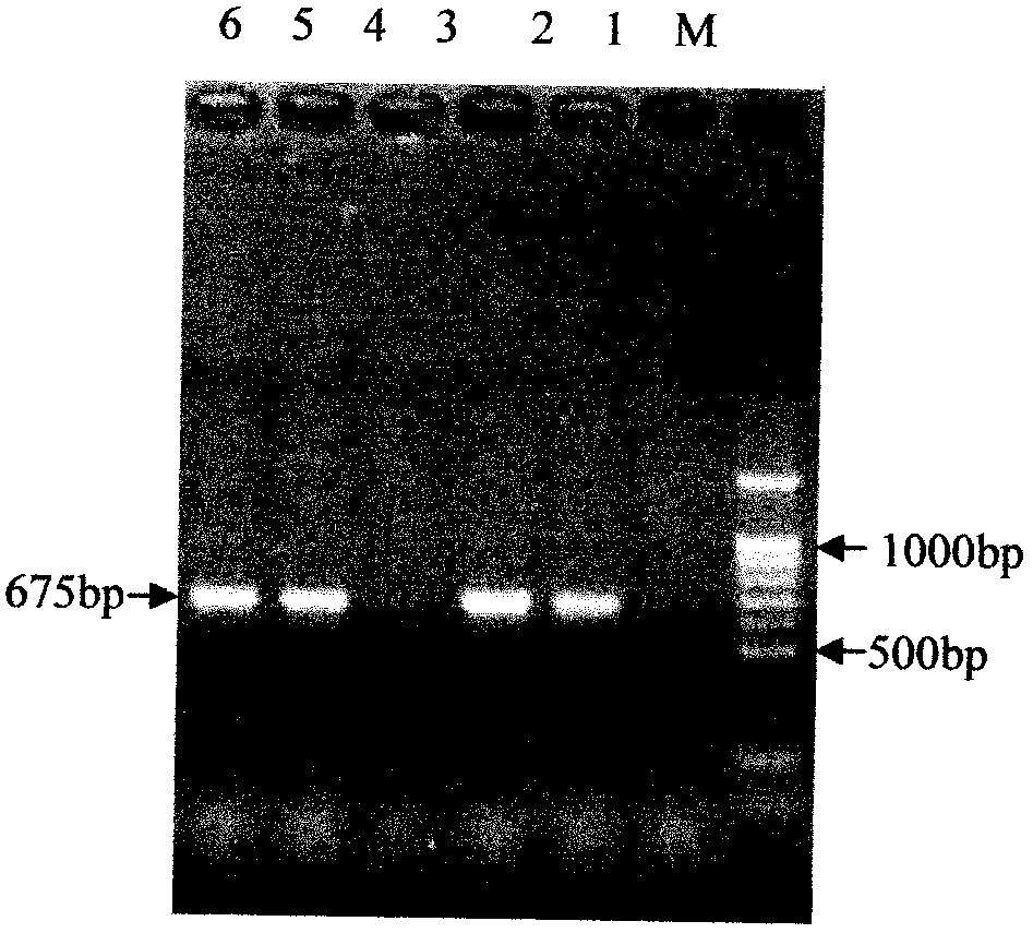 Expression process of coat protein gene of prunus necrotic ring spot virus (PNRSV), antiserum and kit