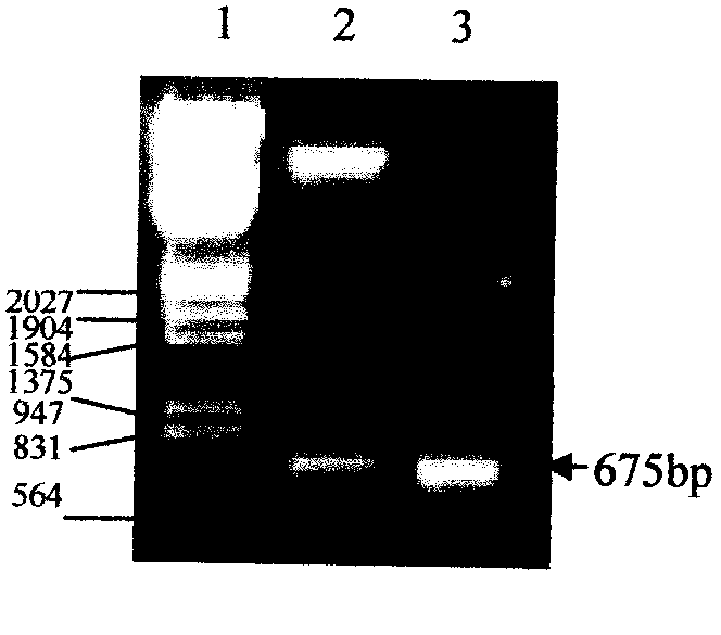 Expression process of coat protein gene of prunus necrotic ring spot virus (PNRSV), antiserum and kit