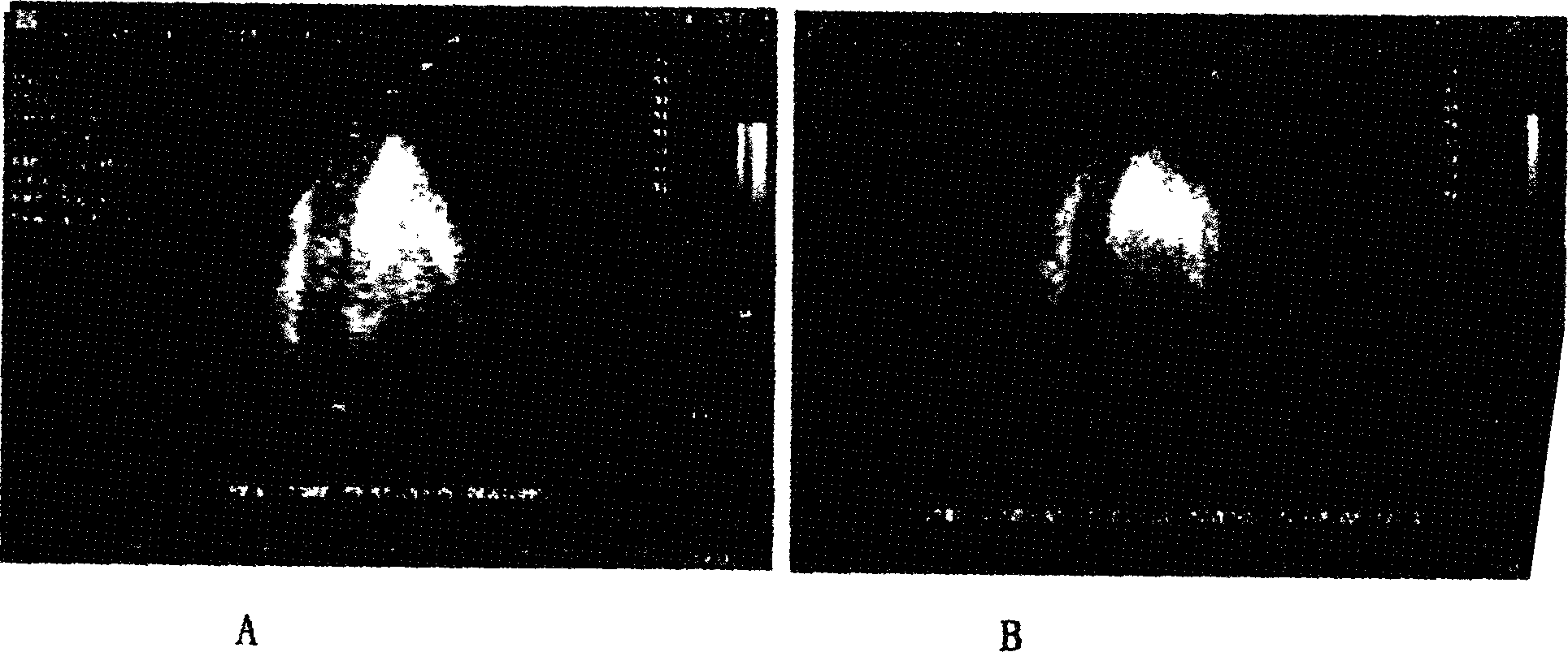 Location controlled releasing method for ultrasonic microbubble contrast medium