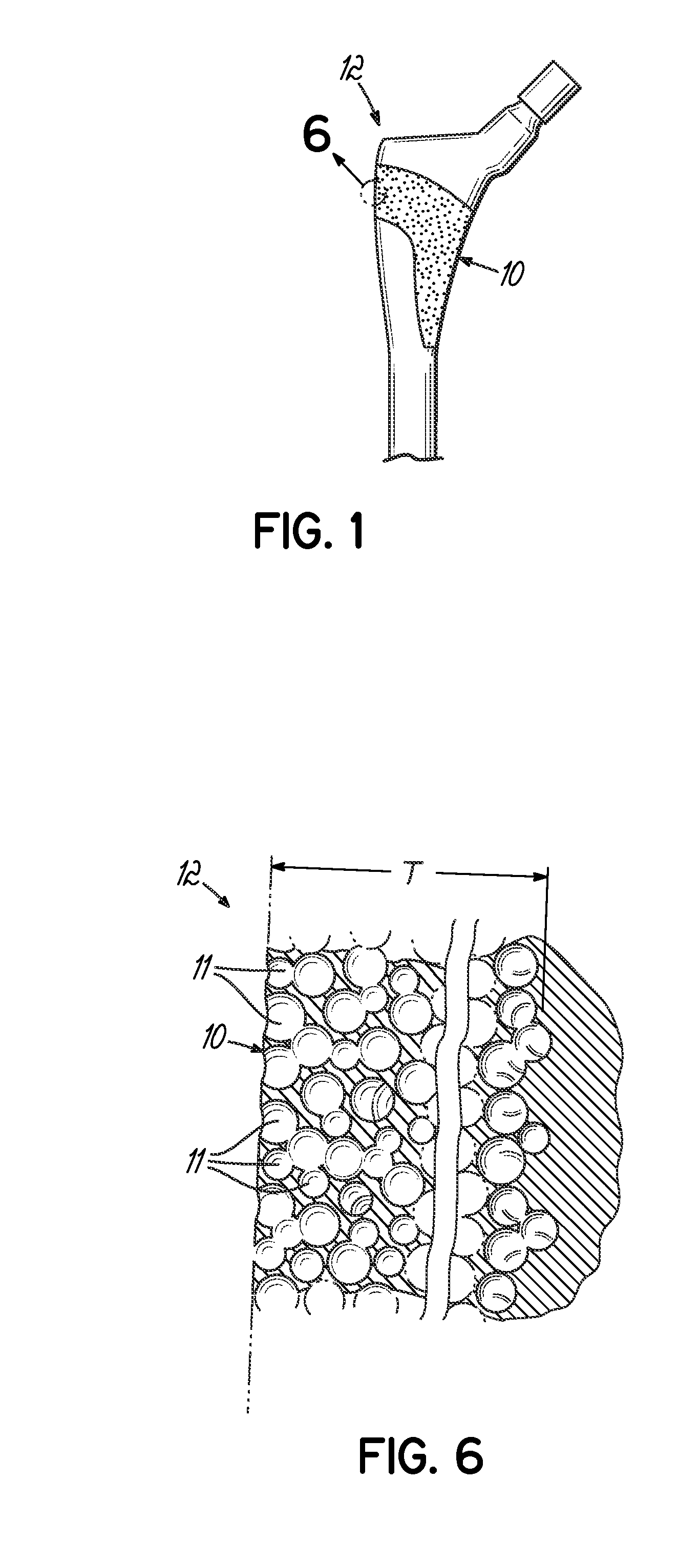 Method for forming an integral porous region in a cast implant